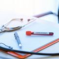 Top Tools for Analyzing and Monitoring Core Web Vitals: A Comprehensive Comparison